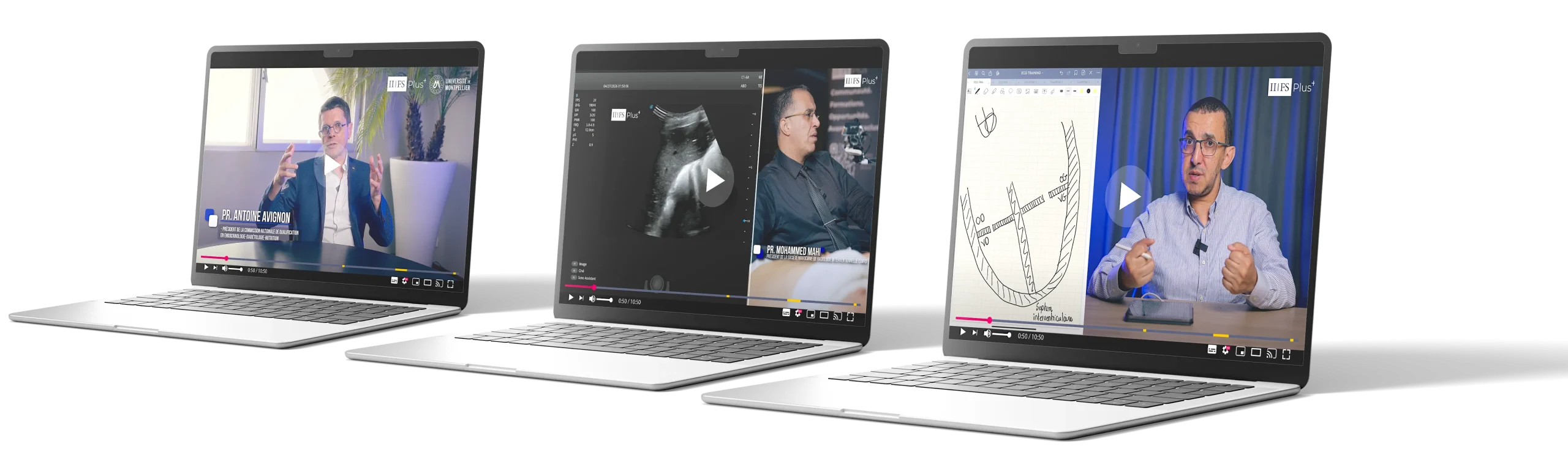 Trois ordinateurs portables affichant des vidéos e-learning IIFS Plus+ — Pr. Antoine Avignon, échographie cardiaque, et Pr. Mohammed Mahi